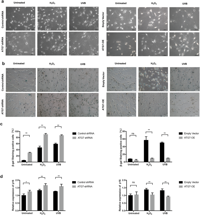Correction: dysfunction of atg7-dependent autophagy dysregulates the antioxidant response and contributes to oxidative stress-induced biological impairments in human epidermal melanocytes