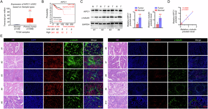 lsm-2004 pimpandhost 1038)))))))''''' KIFC1 depends on TRIM37-mediated ubiquitination of PLK4 to promote  centrosome amplification in endometrial cancer | Cell Death Discovery