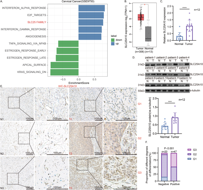 SLC25A10 promotes cisplatin resistance by inhibiting ferroptosis in ...