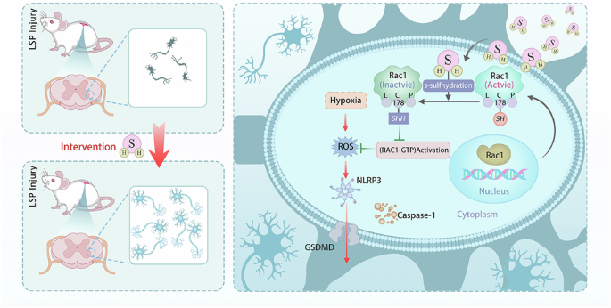 Hydrogen sulfide protects against spinal cord pyroptosis via persulfidation  of Rac1 after lumbosacral plexus nerve injury | Cell Death Discovery