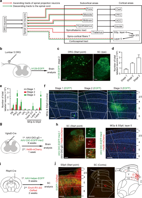 A direct spino-cortical circuit bypassing the thalamus modulates nociception