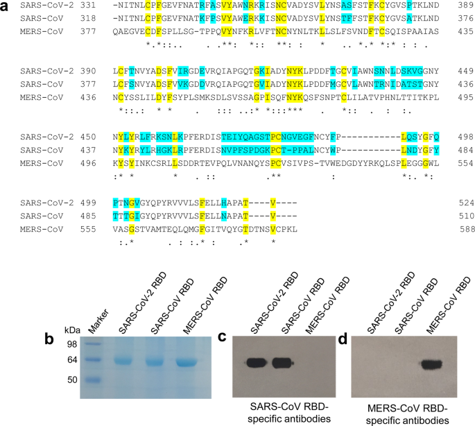 Characterization Of The Receptor Binding Domain Rbd Of 19 Novel Coronavirus Implication For Development Of Rbd Protein As A Viral Attachment Inhibitor And Vaccine Cellular Molecular Immunology