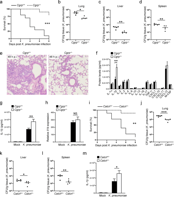 The neuropeptide cgrp enters the macrophage cytosol to suppress the nlrp3 inflammasome during pulmonary infection