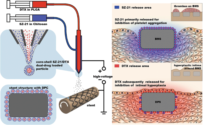 Design And Testing Of Hydrophobic Core Hydrophilic Shell Nano Micro Particles For Drug Eluting Stent Coating Npg Asia Materials