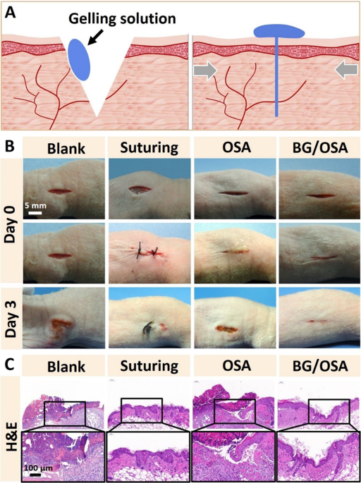 A novel dual-adhesive and bioactive hydrogel activated by bioglass for  wound healing