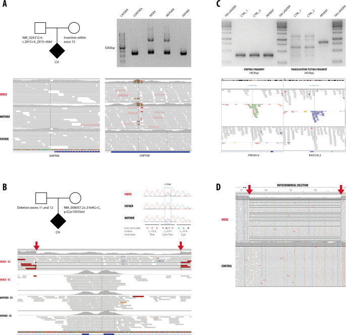 Successful Application Of Genome Sequencing In A Diagnostic Setting 1007 Index Cases From A Clinically Heterogeneous Cohort European Journal Of Human Genetics Successful Application Of Genome Sequencing In A Diagnostic Setting 1007 Index Cases From A Clinically Heterogeneous Cohort European Journal Of Human Genetics