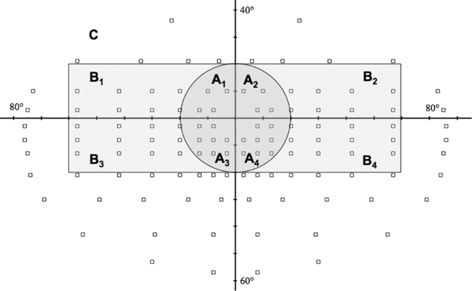 The effects of visual-field loss from panretinal photocoagulation of proliferative diabetic retinopathy on performance in a driving simulator