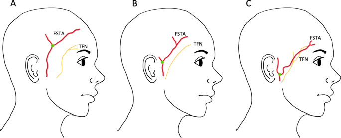 feature-image