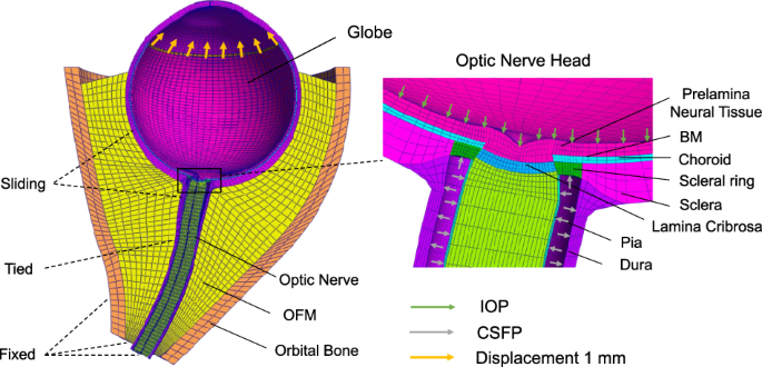 Ciliary muscle traction during accommodation is able to induce optic ...