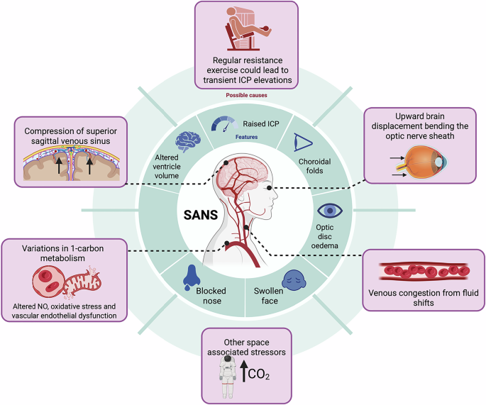 semaglutide tinnitus side effect Risk of Hearing Loss in Patients Treated with Exendin-4 Derivatives: A Network Meta-Analysis of Glucagon-like Peptide-1 Receptor Agonists and Sodium–Glucose Cotransporter 2 Inhibitors Some Mounjaro and Ozempic users