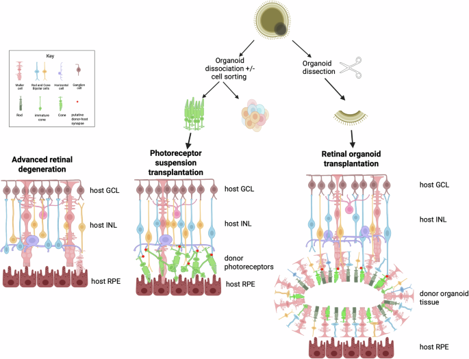 Photoreceptor replacement: a disease-agnostic approach for the treatment of advanced retinal degeneration - Eye