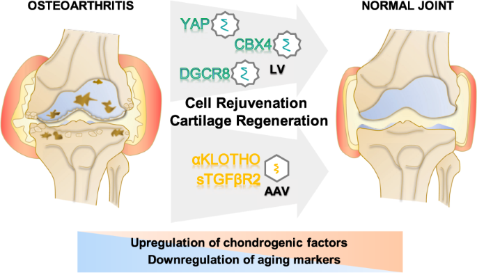 Treating osteoarthritis via gene therapy with rejuvenation factors