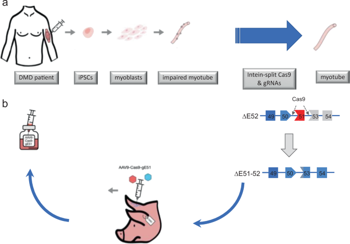 duchenne muscular dystrophy treatment