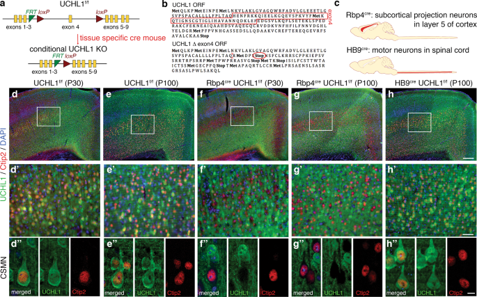 Upper motor neurons are a target for gene therapy and UCHL1 is necessary  and sufficient to improve cellular integrity of diseased upper motor  neurons | Gene Therapy