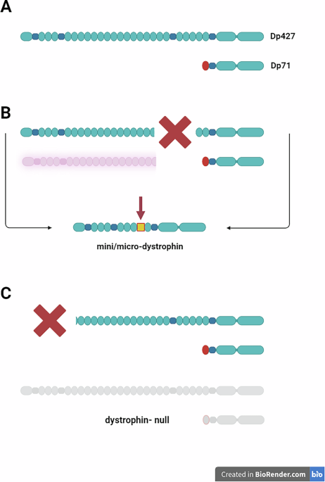 Is dystrophin immunogenicity a barrier to advancing gene therapy for ...