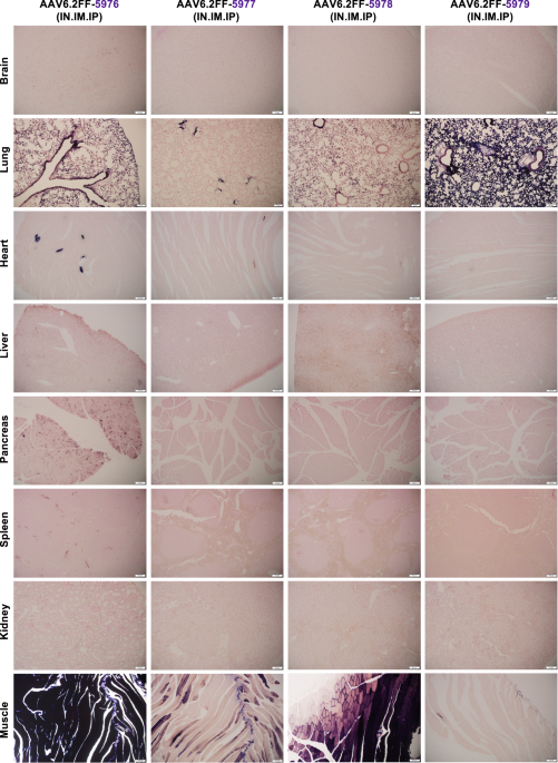 Improving the precision of AAV lung gene therapy for SP-B deficiency using computationally derived lung-specific promoters - Gene Therapy