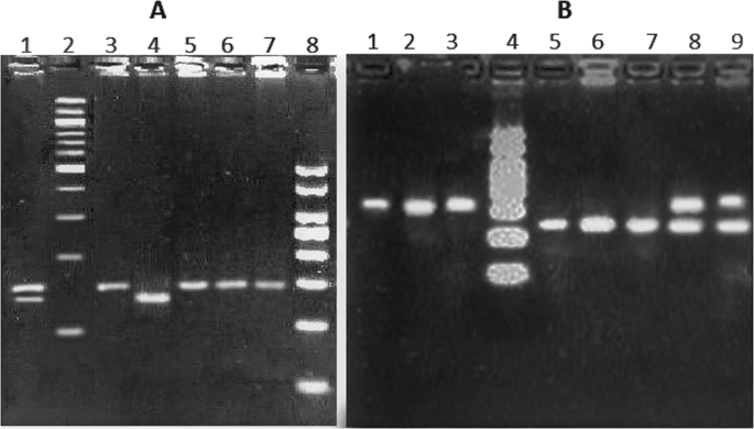 Slc11a1 genetic variation and low expression may cause immune response impairment in tb patients