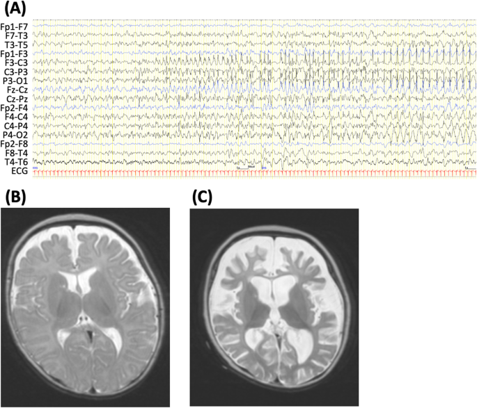 feature-image
