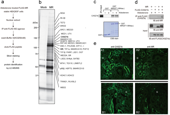 Casz1b is a novel transcriptional corepressor of mineralocorticoid receptor