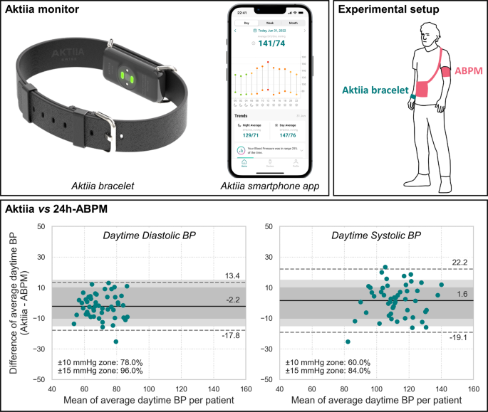 Aktiia cuffless blood pressure monitor yields equivalent daytime blood  pressure measurements compared to a 24-h ambulatory blood pressure monitor:  Preliminary results from a prospective single-center study | Hypertension  Research
