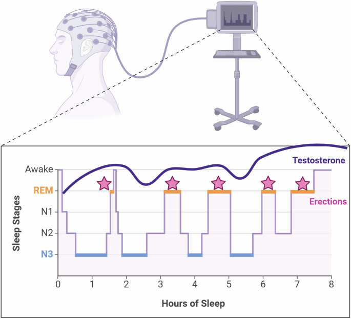 melanotan 2 on middle eastern guy The role of sleep stages in the regulation of erectile function: impacts of REM sleep fragmentation