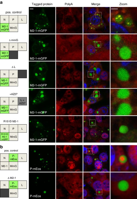 Functional organization of cytoplasmic inclusion bodies in cells infected  by respiratory syncytial virus