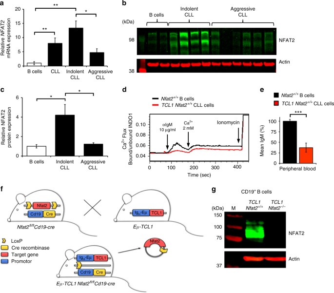 Nfat2 Is A Critical Regulator Of The Anergic Phenotype In Chronic Lymphocytic Leukaemia Nature Communications