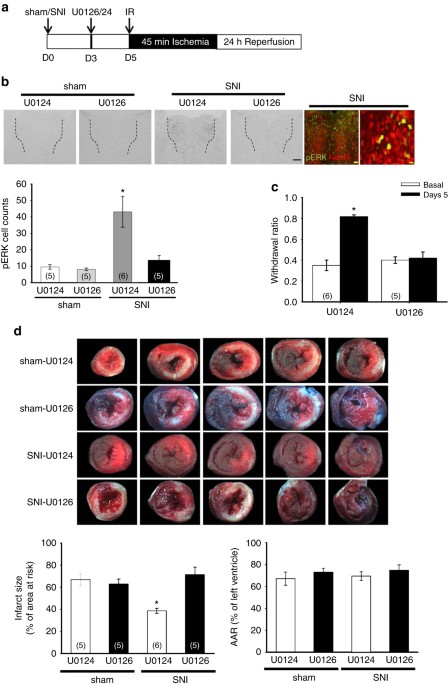 , Cardioprotection induced in a mouse model of neuropathic pain via anterior nucleus of paraventricular thalamus