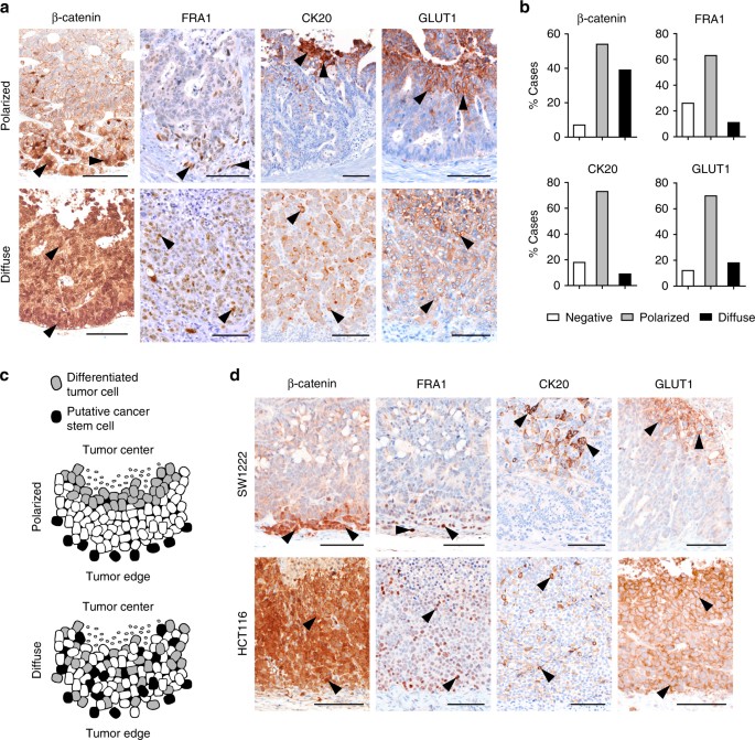 Multicolor lineage tracing reveals clonal architecture and dynamics in colon  cancer | Nature Communications