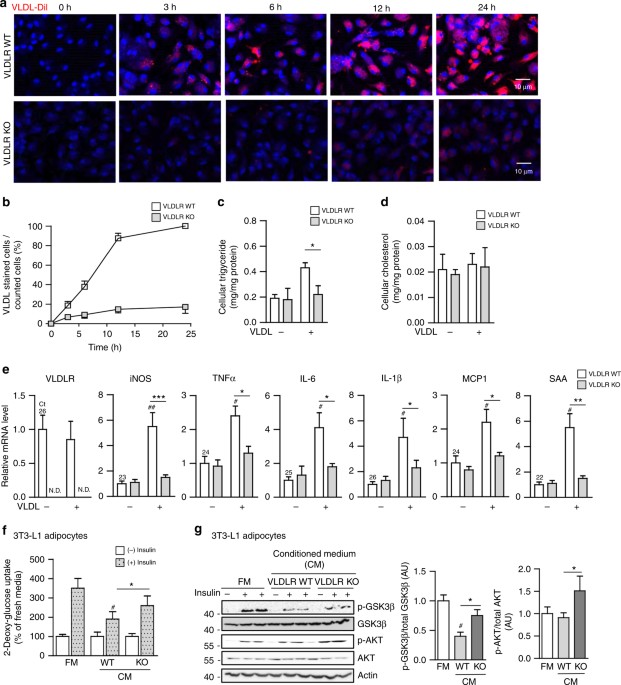 inflammation, Macrophage VLDLR mediates obesity-induced insulin resistance with adipose tissue inflammation