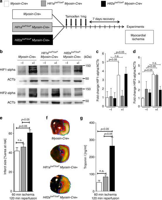 Studies Implicate Early Injury To >> Hypoxia Inducible Factor 2 Alpha Dependent Induction Of Amphiregulin Studies Implicate Early Injury To >> Hypoxia Inducible Factor 2 Alpha Dependent Induction Of Amphiregulin