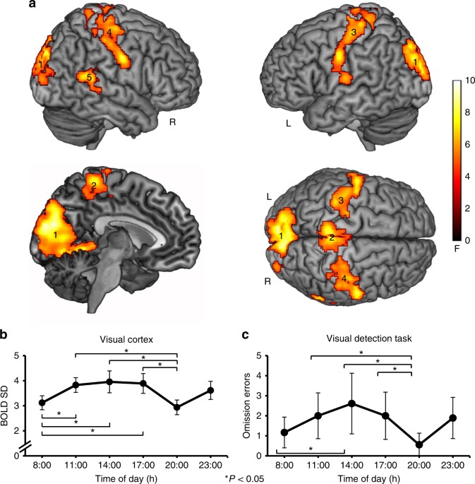 brain scan visualization showing neural activity during time-based hooks with orange highlighted regions