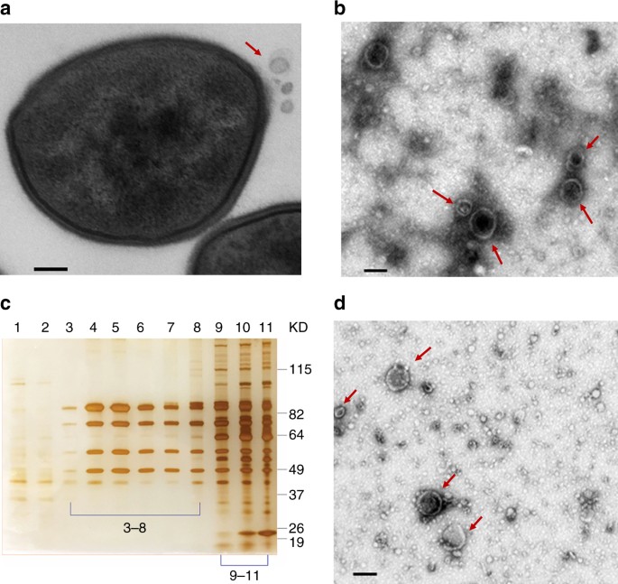 Release of Staphylococcus aureus extracellular vesicles and their  application as a vaccine platform