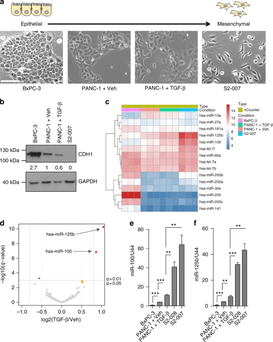 tgf β induces mir 100 and mir 125b but blocks let 7a through lin28b