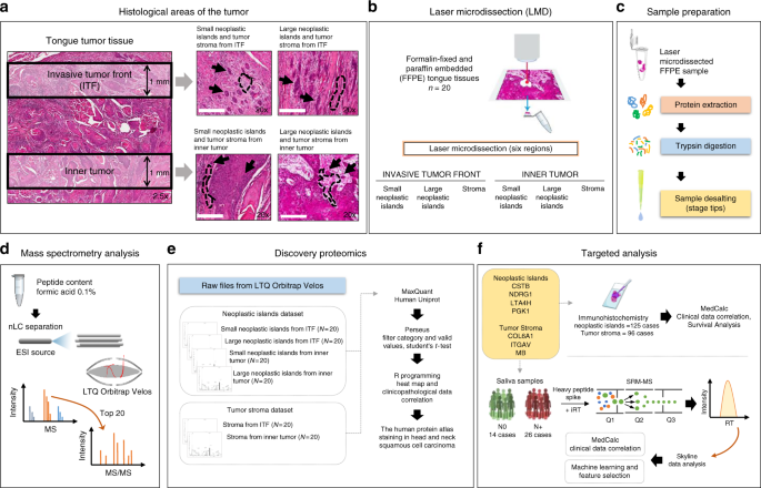 Combining discovery and targeted proteomics reveals a prognostic signature  in oral cancer | Nature Communications