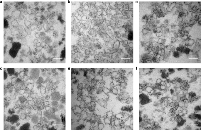 De Novo Targeting To The Cytoplasmic And Luminal Side Of Bacterial Microcompartments Nature Communications