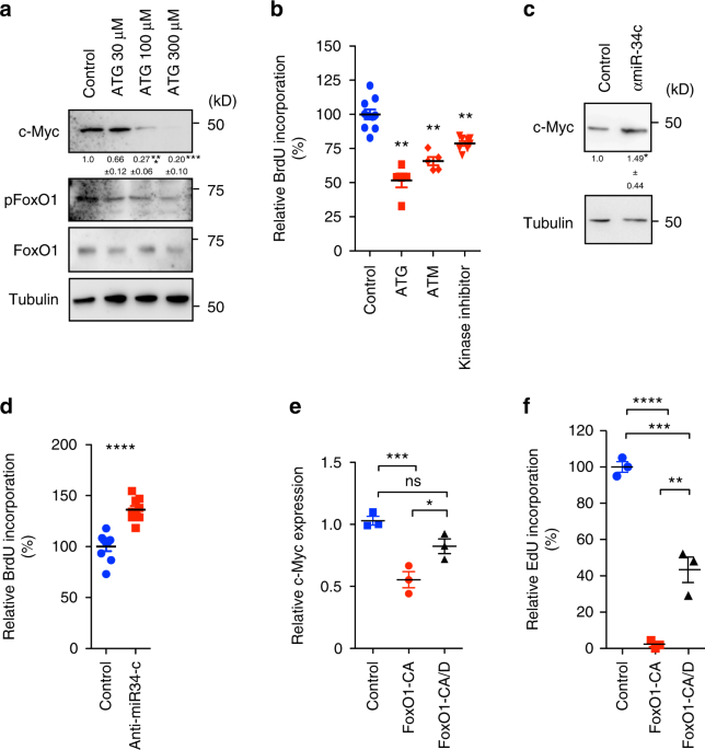 aPKC controls endothelial growth by modulating c-Myc via FoxO1 DNA
