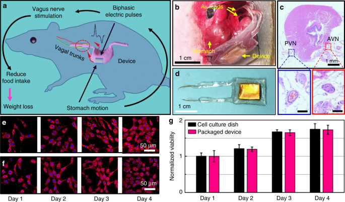 Self-powered implantable device stimulates fast bone healing, then