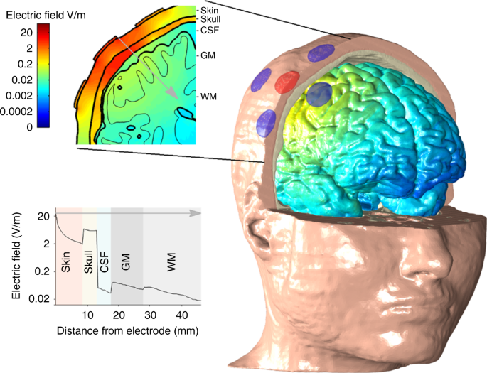 Figure 1 from Brain surface temperature under a craniotomy.
