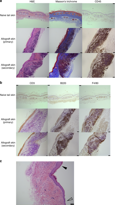 Hematopoietic chimerism and donor-specific skin allograft tolerance ...