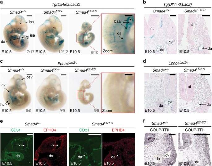 Venous Identity Requires Bmp Signalling Through Alk3 Nature Communications