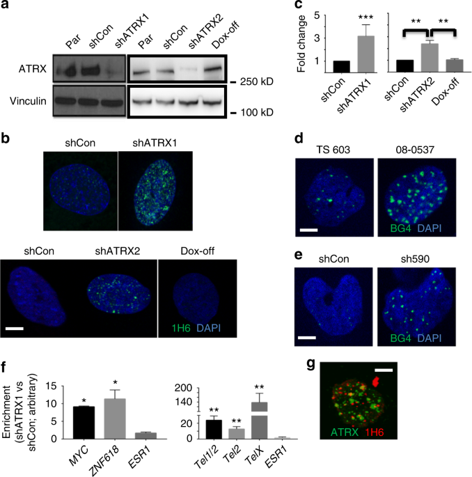 G Quadruplex Dna Drives Genomic Instability And Represents A Targetable Molecular Abnormality In Atrx Deficient Malignant Glioma Nature Communications