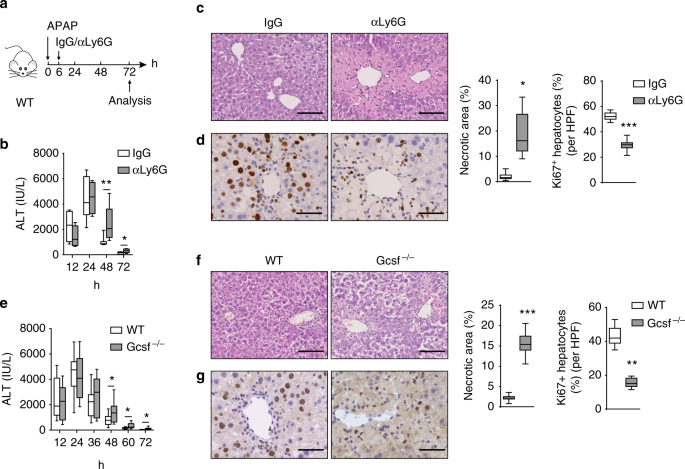 Neutrophils Promote The Development Of Reparative Macrophages Mediated By Ros To Orchestrate Liver Repair Nature Communications