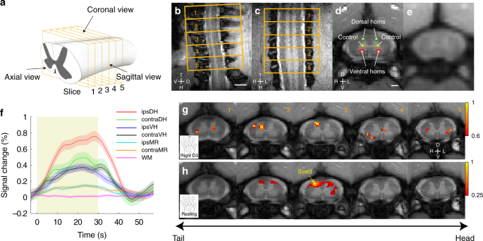 Intrinsic Functional Architecture Of The Non Human Primate Spinal Cord Derived From Fmri And Electrophysiology Nature Communications