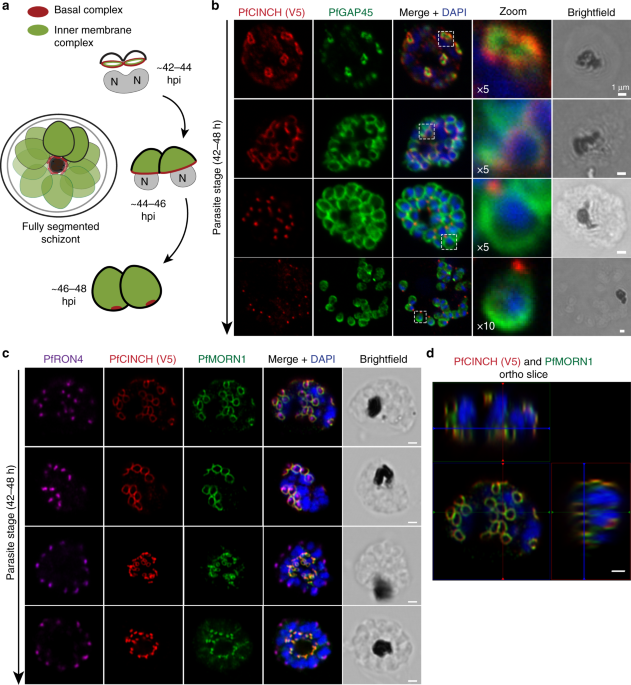 An Essential Contractile Ring Protein Controls Cell Division In Plasmodium Falciparum Nature Communications An Essential Contractile Ring Protein Controls Cell Division In Plasmodium Falciparum Nature Communications