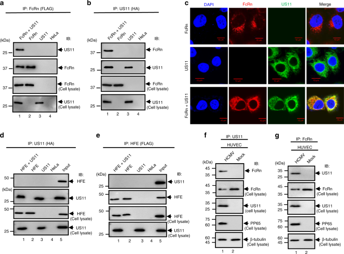 QnA VBage Human cytomegalovirus evades antibody-mediated immunity through endoplasmic reticulum-associated degradation of the FcRn receptor