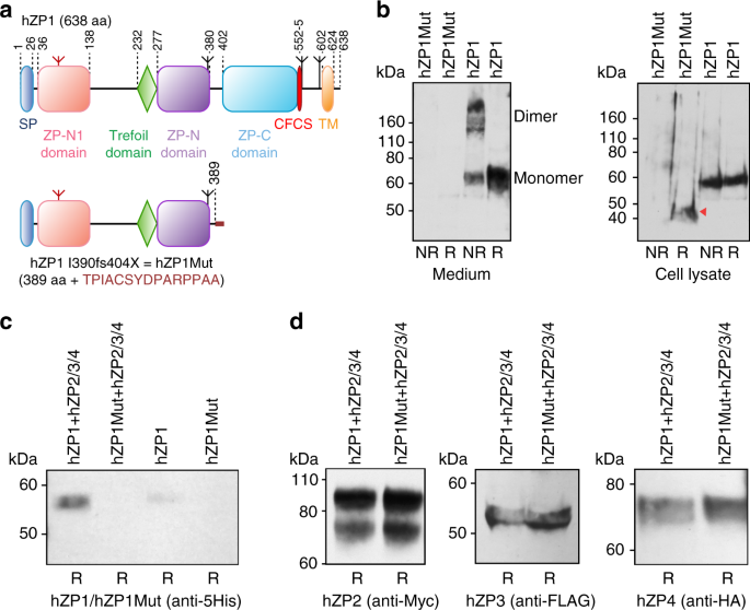 Molecular Basis Of Egg Coat Cross Linking Sheds Light On Zp1 Associated Female Infertility Nature Communications Molecular Basis Of Egg Coat Cross Linking Sheds Light On Zp1 Associated Female Infertility Nature Communications