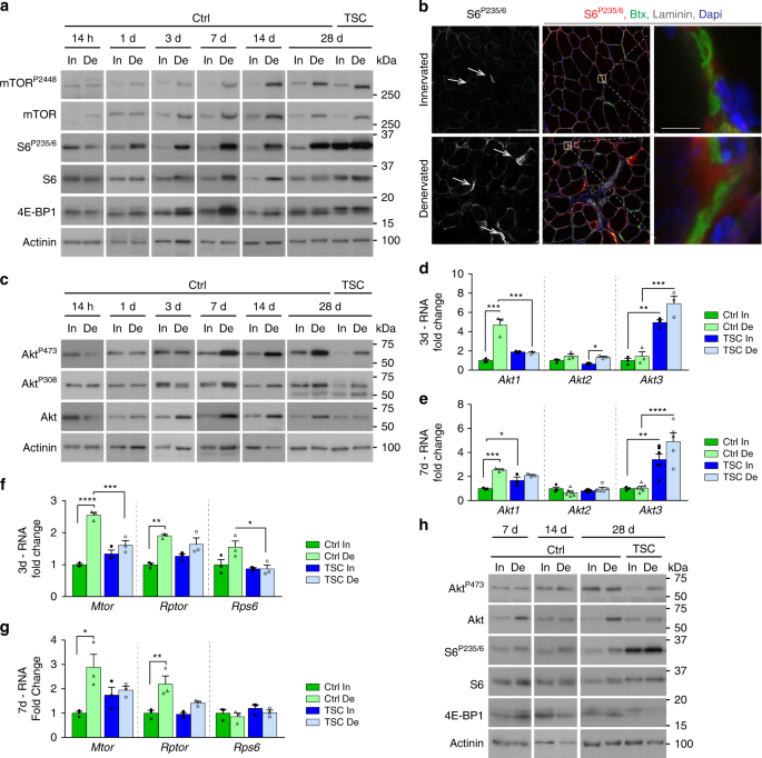 mTORC1 and PKB/Akt control the muscle response to denervation by regulating  autophagy and HDAC4 | Nature Communications