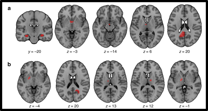 human brain mapping manuscript revision human brain mapping manuscript revision