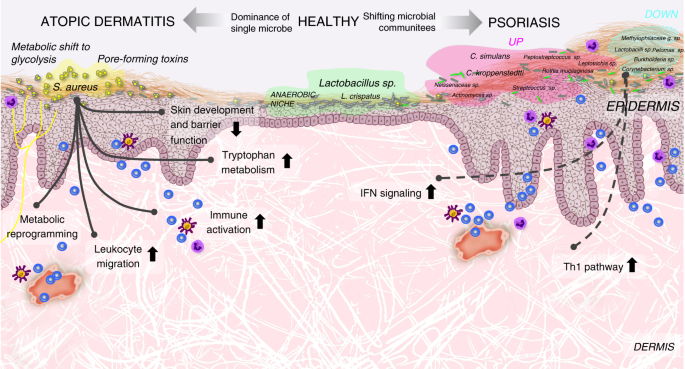 Staphylococcus aureus: A Blemish on Skin Immunity: Cell Host & Microbe